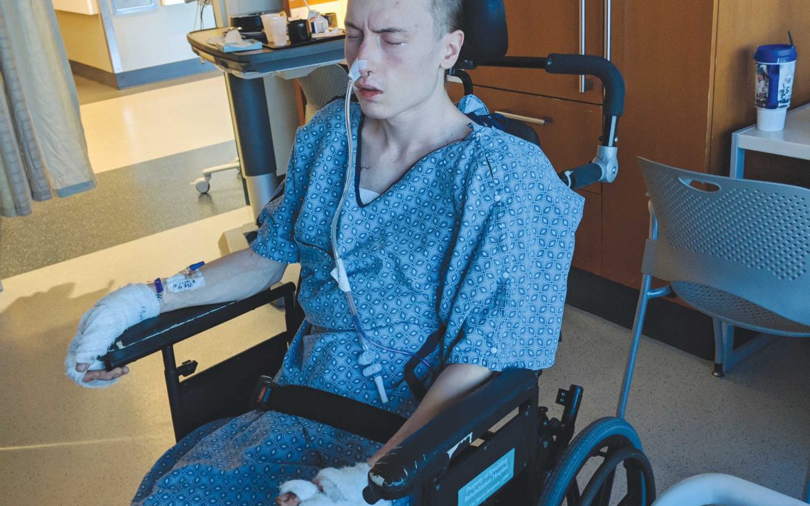 Keene student recovering from car crash The Equinox