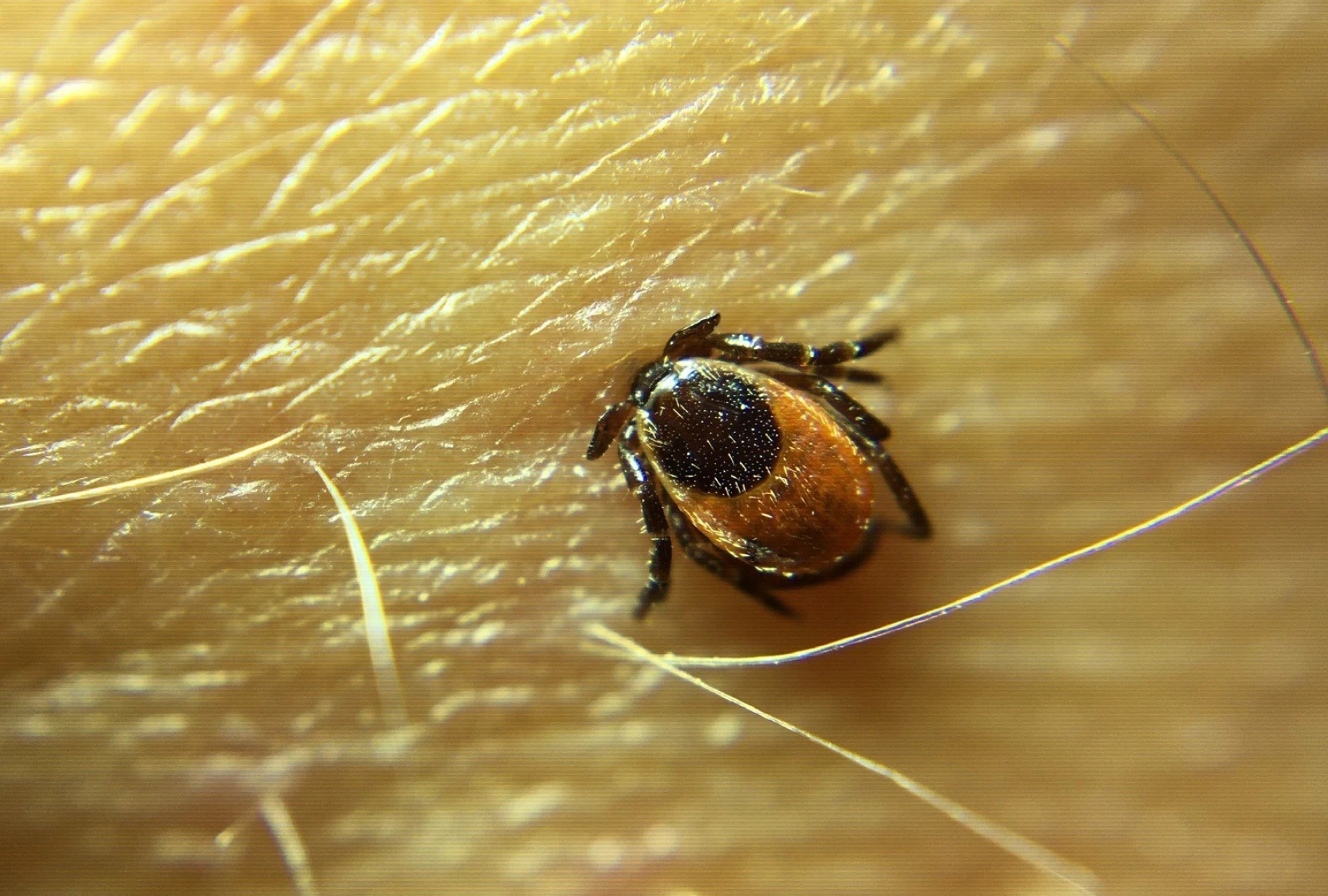 It's tick season in New England. Here's how to stay safe.
